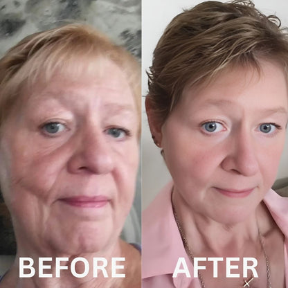 Restore Your Glow with NAD+ Glow Restore™