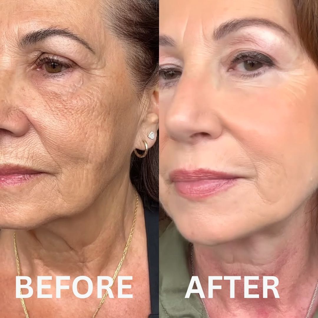 Restore Your Glow with NAD+ Glow Restore™