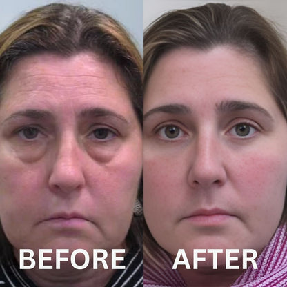 Restore Your Glow with NAD+ Glow Restore™