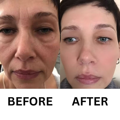 Restore Your Glow with NAD+ Glow Restore™