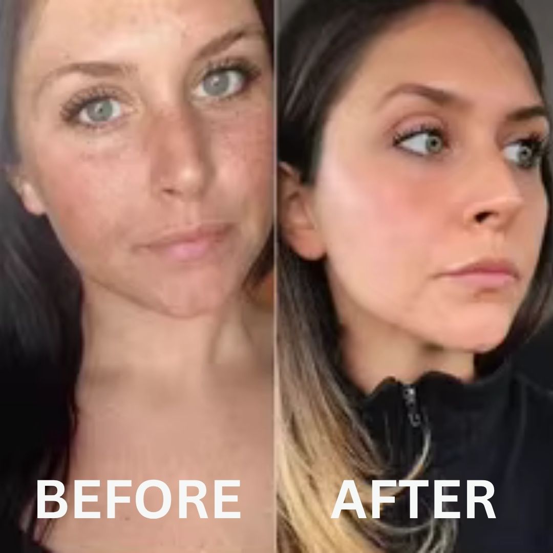 Restore Your Glow with NAD+ Glow Restore™