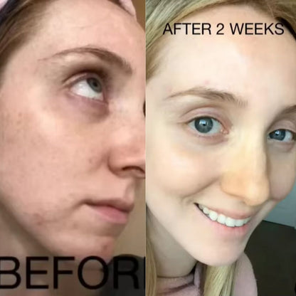 Restore Your Glow with NAD+ Glow Restore™