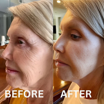 Restore Your Glow with NAD+ Glow Restore™